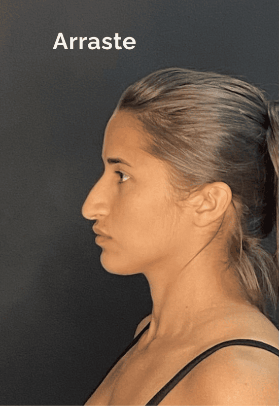 paciente-1-pre-sim paciente-1-pre-sim