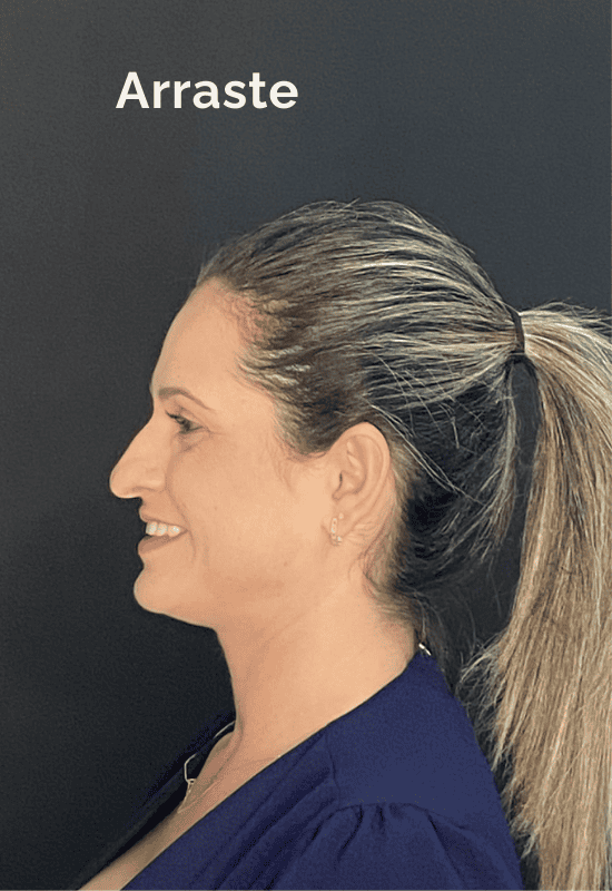 paciente-2-pre-sim paciente-2-pre-sim