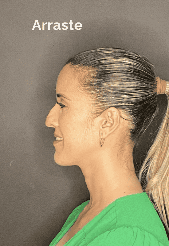 paciente-3-pre-sim paciente-3-pre-sim